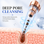 Electric Vacuum Blackhead Remover.